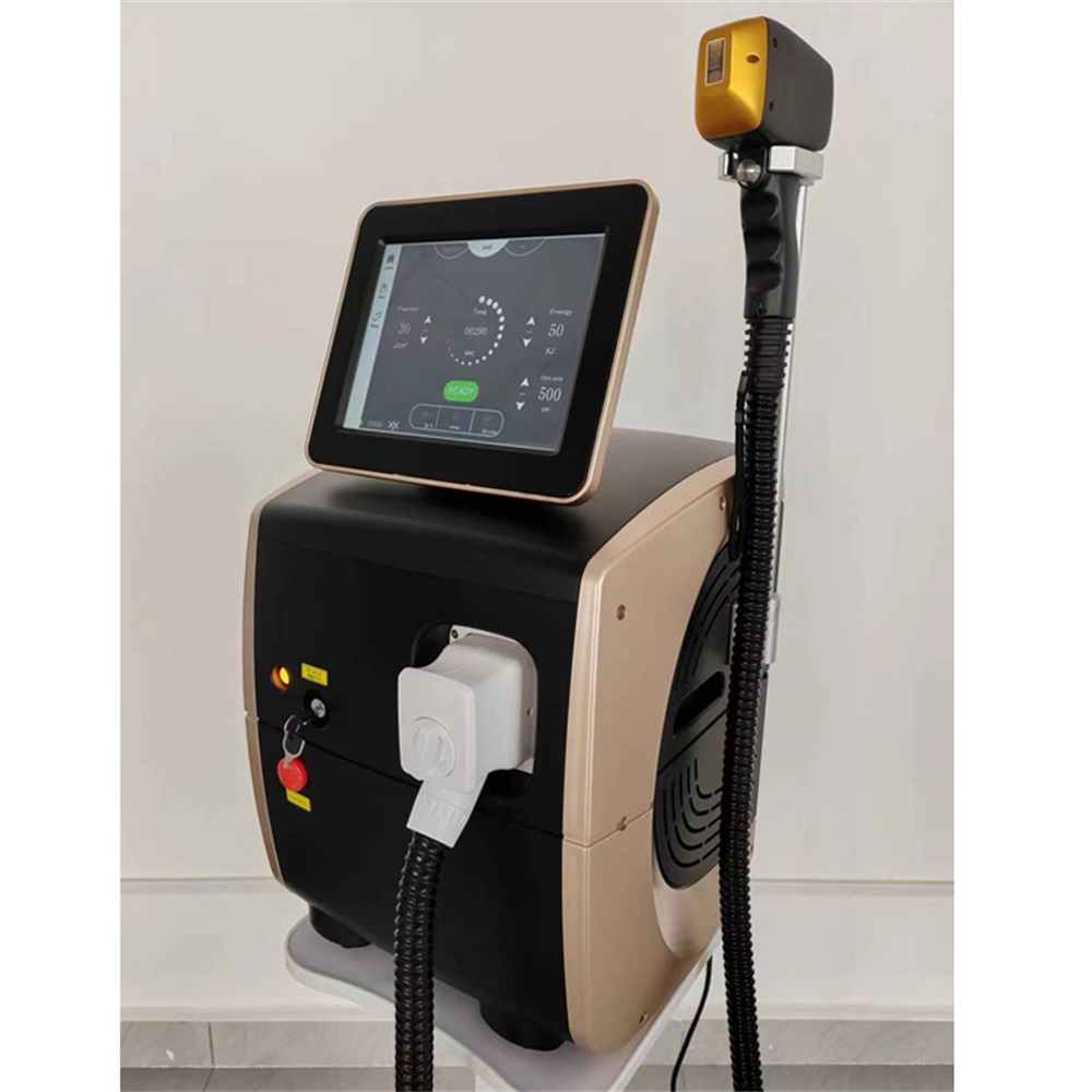 2026 Hochleistungs-Diodenlaser – Industrial Laser Cleaning Machine Bewertung und Preis